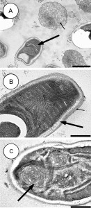 "Parasite140027-fig5 Dictyocoela diporeiae Winters & Faisal, 2014 transmission electron micrographs" by Andrew David Winters & Mohamed Faisal - Winters, A. D., Faisal, M. 2014. Molecular and ultrastructural characterization of Dictyocoela diporeiae n. sp. (Microsporidia), a parasite of Diporeia spp. (Amphipoda, Gammaridea). Parasite, 21, 26 doi:10.1051/parasite/2014028. Licensed under CC BY 2.0 via Wikimedia Commons.